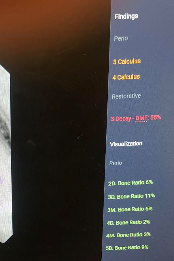 overjet visualization