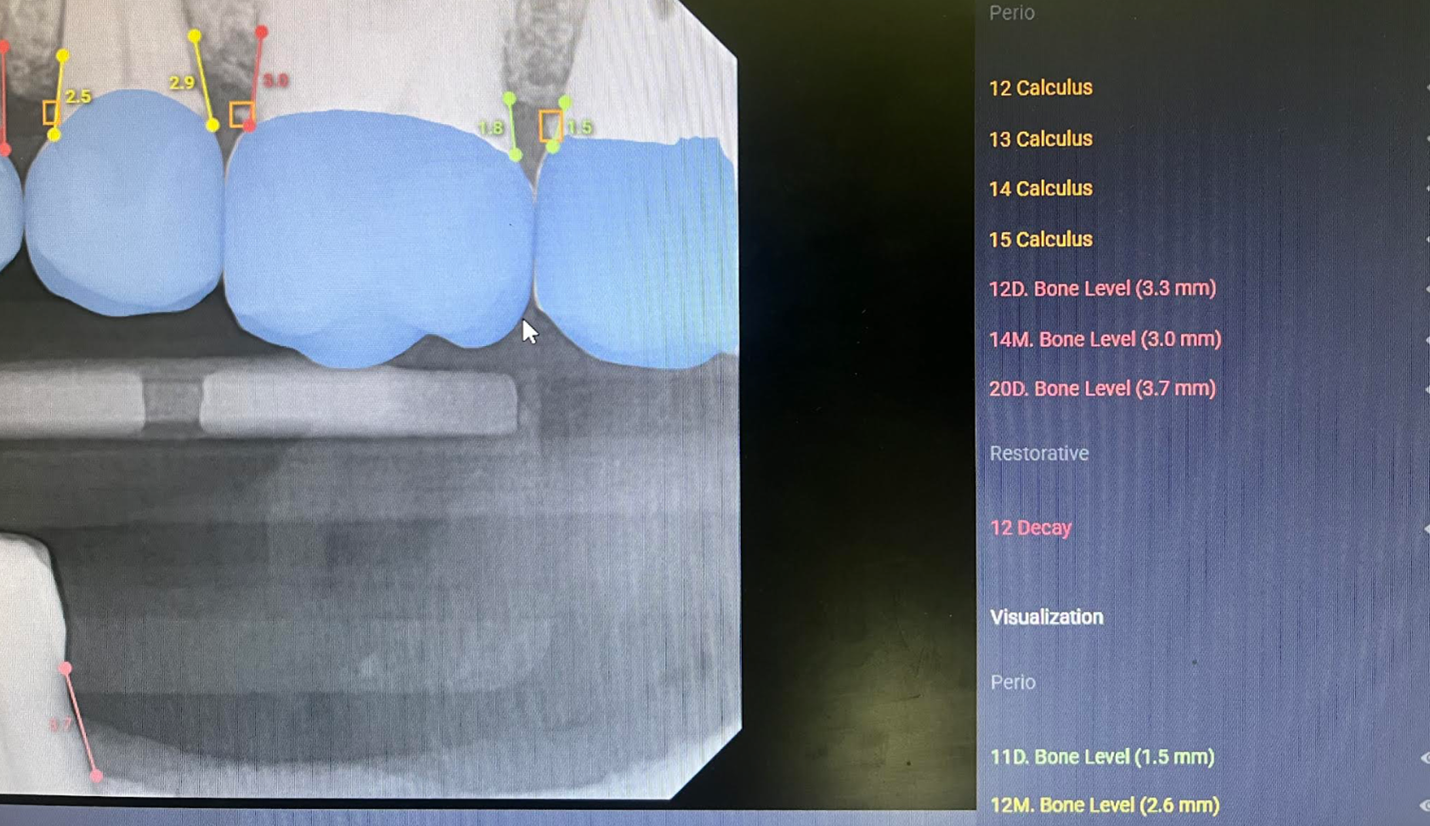 overjet insurance denial